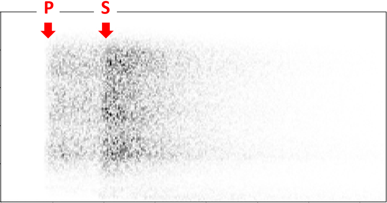 Spectrogramme traité